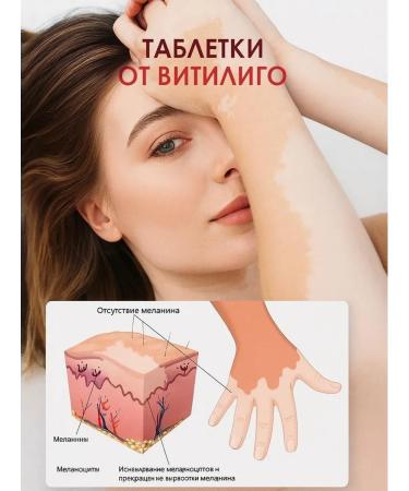 Tubrik Treatment of pigmentation bleaching of the skin of vitiligo 48 pcs - Buy Online on GoSupps.com