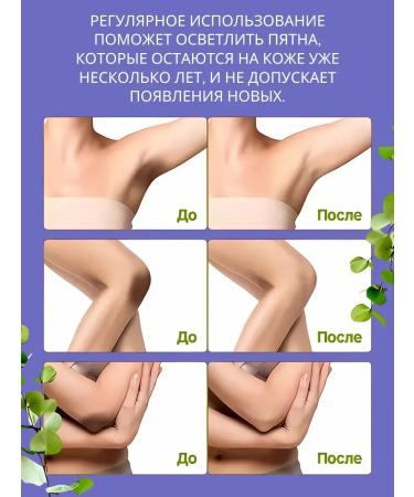 VALLEY whitening cream from black spots with armpits between the legs - Buy Online on GoSupps.com