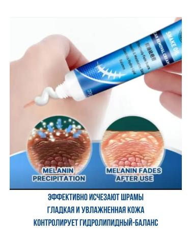 Janar brands Cream from scars and scars snake oil is effective - Buy Online on GoSupps.com