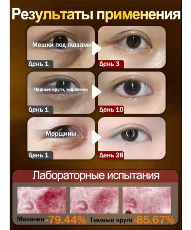 LYDIMOON Cream around the eyes from edema and bags - Buy Online on GoSupps.com