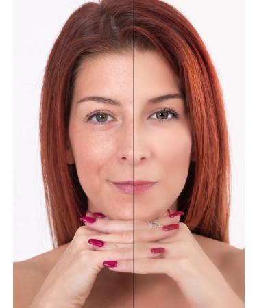 Zzikoo Cream for correction of hyperpigmentation on the face and body - Buy Online on GoSupps.com