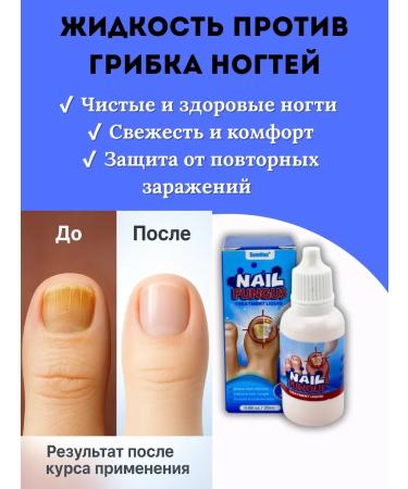 house 78 Anti-nail fungus liquid - Buy Online on GoSupps.com