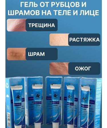 AilunaI 5pcs cream from scars and scars stretch marks on the body and on the face