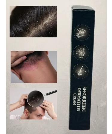 EL1 Cream for scalp dermatitis and dandruff - Buy Online on GoSupps.com