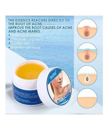 MaxWish 09 Acne cream from acne - Buy Online on GoSupps.com