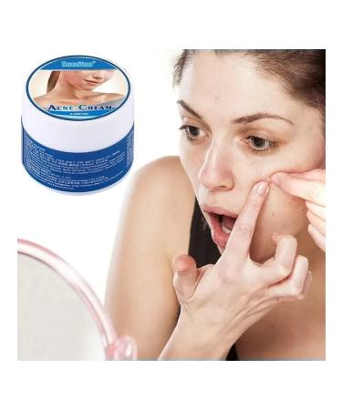 MaxWish 09 Acne cream from acne - Buy Online on GoSupps.com