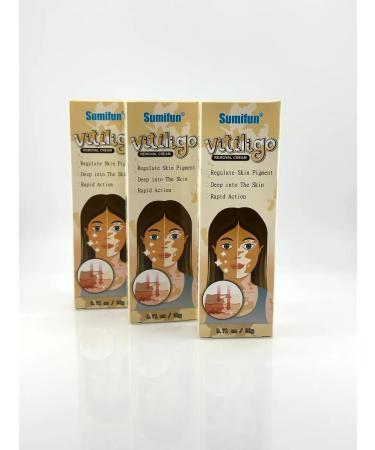 dreamer Vitiligo treatment - Buy Online on GoSupps.com