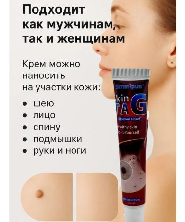 COME 3 Cream from papil and warts - Buy Online on GoSupps.com