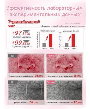 Ephlics Face cream anti -aging moisturizing nutrient 30g - Buy Online on GoSupps.com
