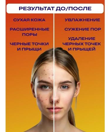 Cleaning mask of acne and black dots - Buy Online on GoSupps.com