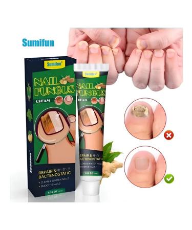 Ointment from nail fungus antifungal 30 ml - Buy Online on GoSupps.com