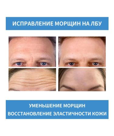 eelhoe Collagen patch for forehead smoothes wrinkles moisturize the skin - Buy Online on GoSupps.com