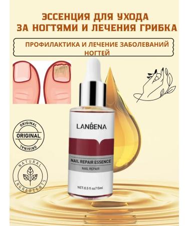 Mooney Nail restoration essence for fungi serum for the treatment of paronychia treatment of onychomycosis for nail care
