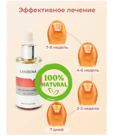 Mooney Nail restoration essence for fungi serum for the treatment of paronychia treatment of onychomycosis for nail care - Buy Online on GoSupps.com