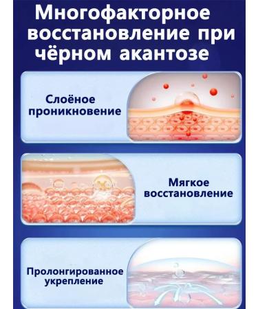 Skin peeling cream after tanning 50 g - Buy Online on GoSupps.com