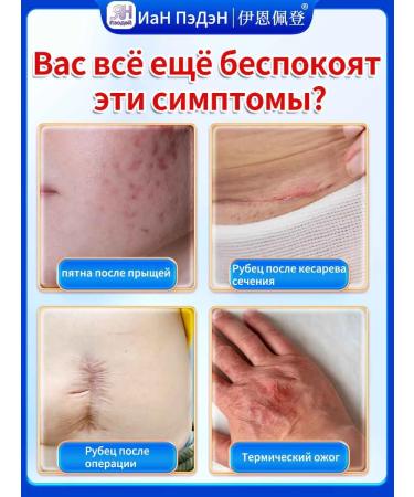 yi en pei deng Cream from scars and scars - Buy Online on GoSupps.com