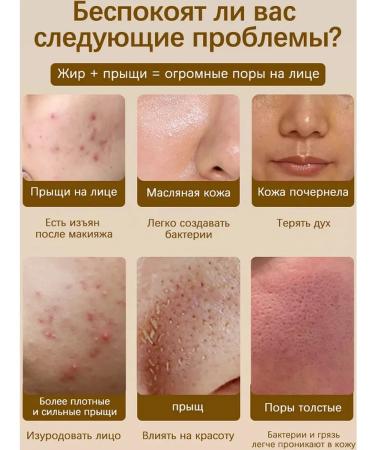 LYDIMOON Facial serum for narrowing pores with lactobionic acid - Buy Online on GoSupps.com