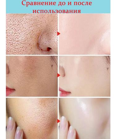 LYDIMOON Facial serum for narrowing pores with lactobionic acid - Buy Online on GoSupps.com