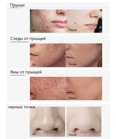 LYDIMOON Facial serum for narrowing pores with lactobionic acid - Buy Online on GoSupps.com