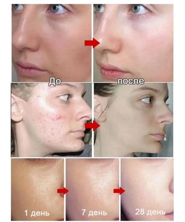 Facial facial mask with niacinamide 5pcs - Buy Online on GoSupps.com