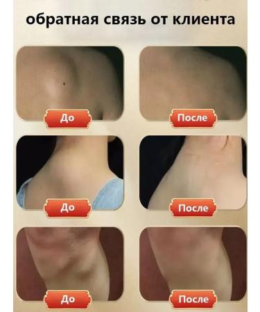 Ointment from Lipoma and Giroviks - Buy Online on GoSupps.com