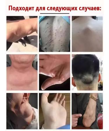 Ointment from Lipoma and Giroviks - Buy Online on GoSupps.com