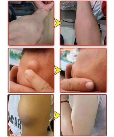 Ointment from Lipoma and Giroviks - Buy Online on GoSupps.com