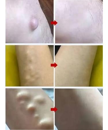 Ointment from Lipoma and Giroviks - Buy Online on GoSupps.com