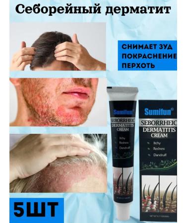 mali21 Cream from seborrheic dermatitis