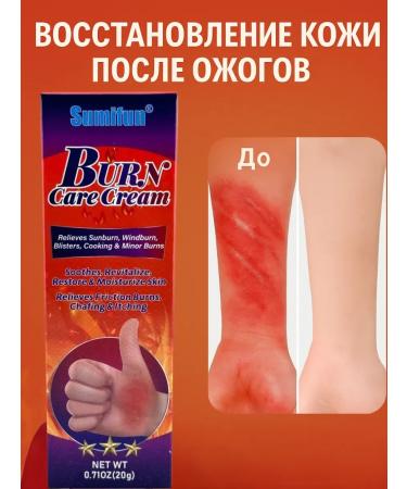 OLBY Cream from burns of sunny and blisters for tanning - Buy Online on GoSupps.com