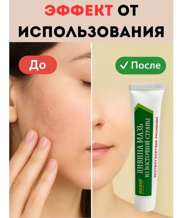 OLBY Herpes psoriasis and dermatitis ointment effective for the body and hands (5 pcs.) - Buy Online on GoSupps.com