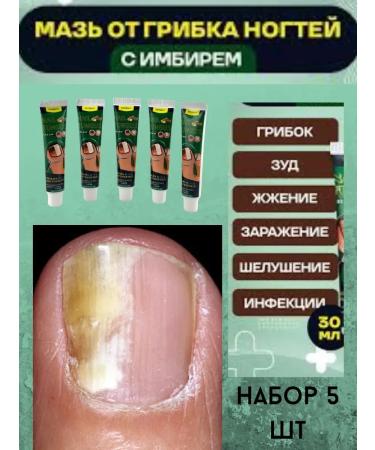 Leila ointment for nail fungus