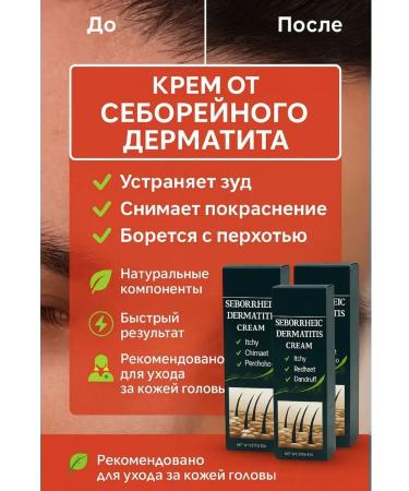 Vlar Cream from seborrheic dermatitis dandruff and itching 3 pcs