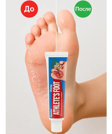 OLBY Ointment from the fungus of nails on the legs between the fingers China 3 pcs - Buy Online on GoSupps.com