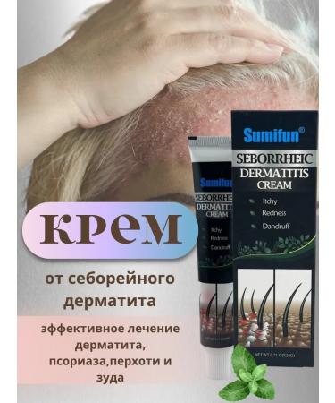 alma2 Cream from seborrheic dermatitis is effective
