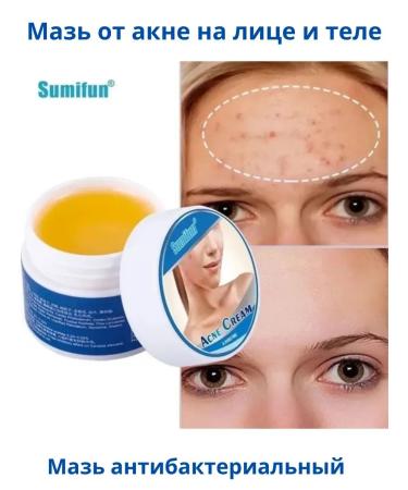 BiuG Acne ointment and acne on the face and body