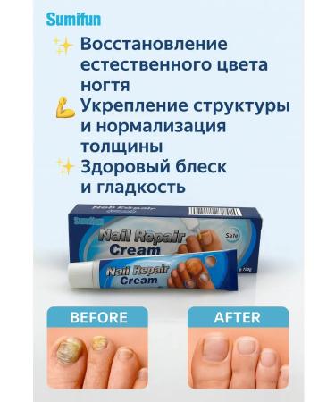 Aku15 Cream for restoration of nails. Against the fungus and yellowness - Buy Online on GoSupps.com