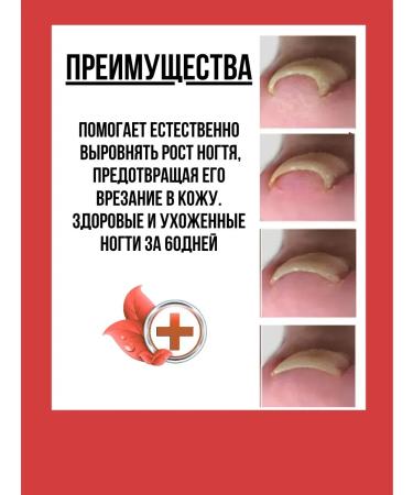 Alma serum anesthetic from an ingrown nail inflammation - Buy Online on GoSupps.com