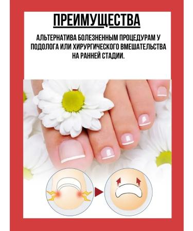 Alma A tool for softening ingrown nails and skin of the fingers 5pcs - Buy Online on GoSupps.com