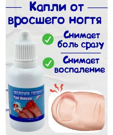 NT83 Drops from an ingrown nail on the legs