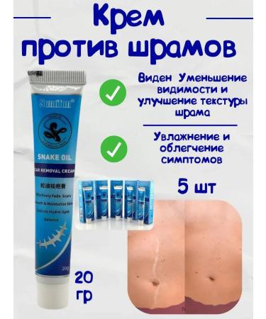 NT83 Cream against scars and scars on the body