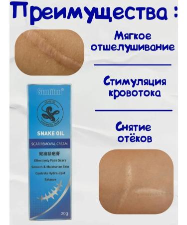 NT83 Cream against scars and scars on the body - Buy Online on GoSupps.com