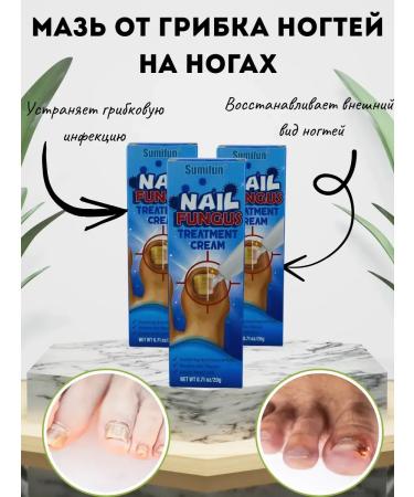 Kalis Ointment from nail fungus on the legs 3pcs