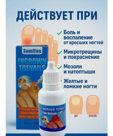 PN95 Remedy for ingrown nails protection against fungi and bacteria - Buy Online on GoSupps.com