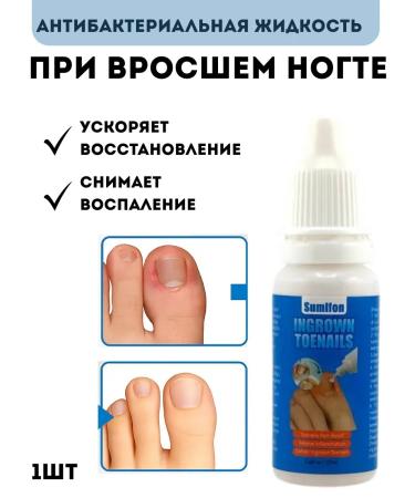 mua Chinese remedy softener for ingrown nails on the legs - Buy Online on GoSupps.com