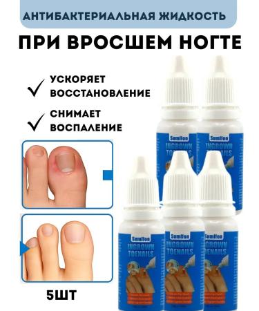 mua Remedy for the restoration of ingrown nails 5 pcs