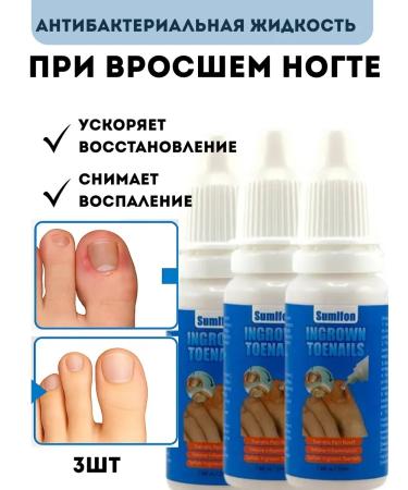 mua Remedy for restoring ingrown nails without pain 3pcs - Buy Online on GoSupps.com