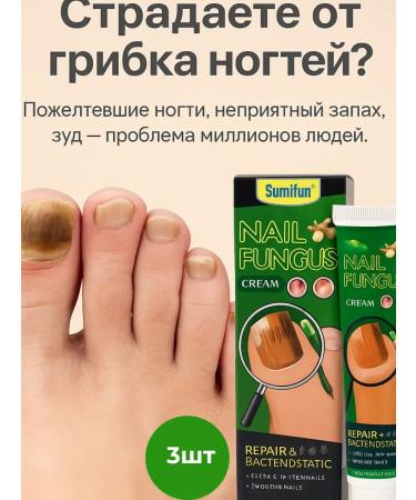 MAC1 Antifungal cream for nails and skin 3pcs