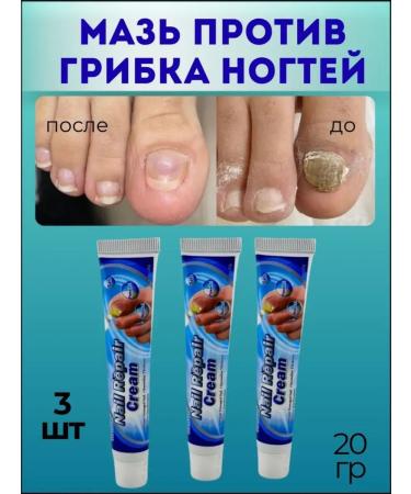 NT83 Ointment against the fungus on nails set 3pcs