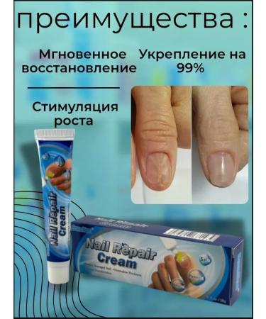 NT83 Ointment against the fungus on nails set 3pcs - Buy Online on GoSupps.com